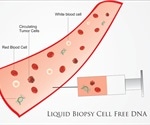 What are Liquid Biopsies?