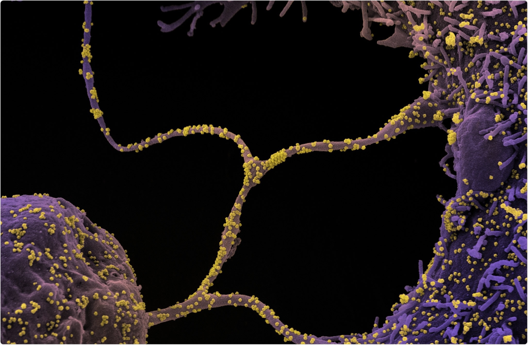 Study: Molecular dynamic simulation reveals E484K mutation enhances spike RBD-ACE2 affinity and the combination of E484K, K417N and N501Y mutations (501Y.V2 variant) induces conformational change greater than N501Y mutant alone, potentially resulting in an escape mutant. Image Credit: NIAID