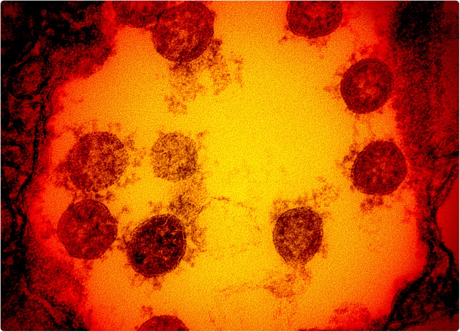 Study: SARS-CoV-2 induces a durable and antigen specific humoral immunity after asymptomatic to mild COVID-19 infection. Image Credit: NIAID