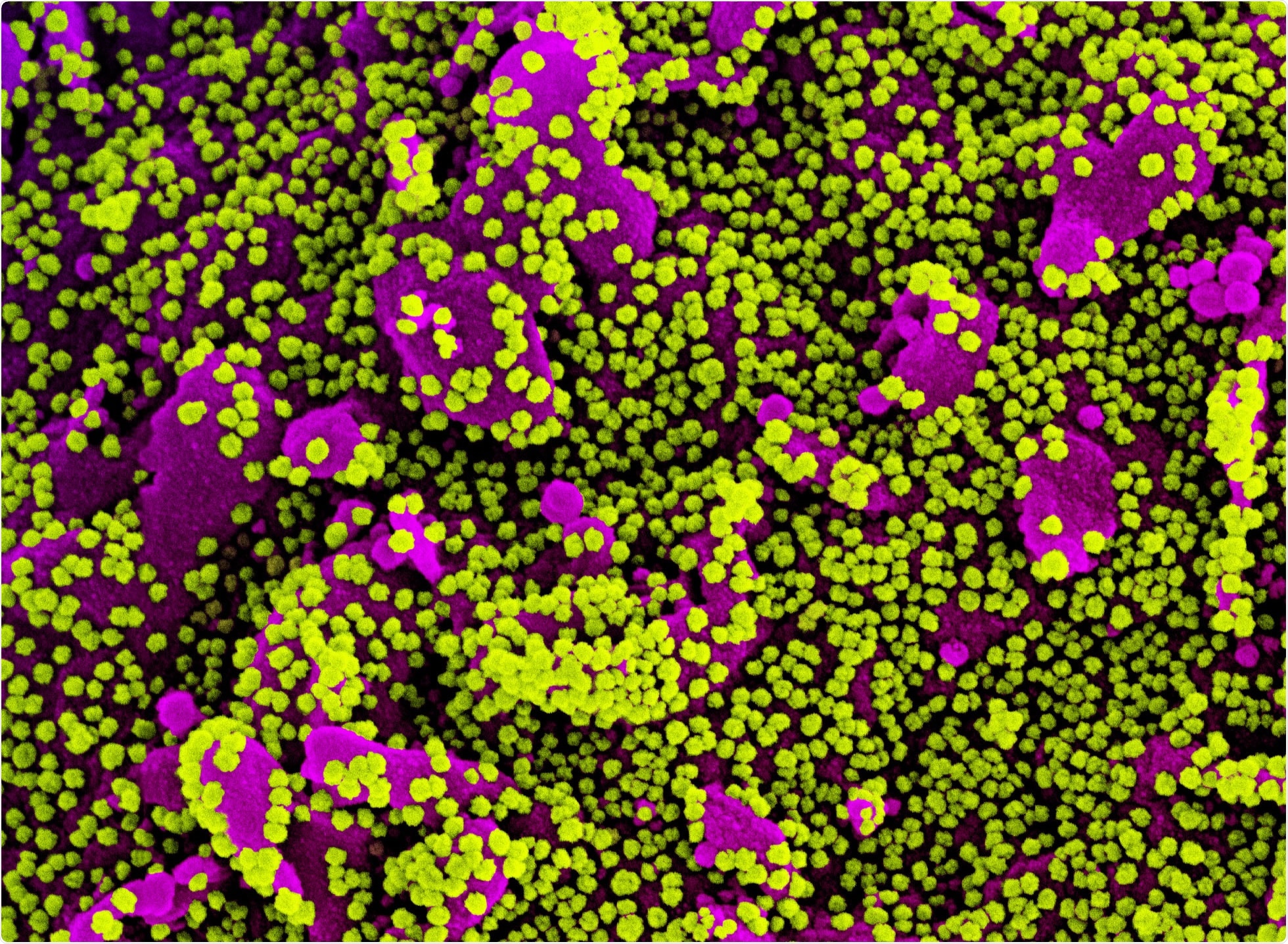 Study: SARS-CoV-2 501Y.V2 escapes neutralization by South African COVID-19 donor plasma. Image Credit: NIAID
