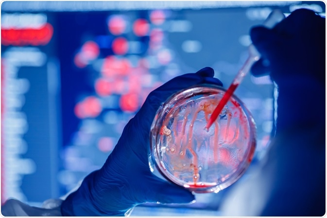 bacterial identification