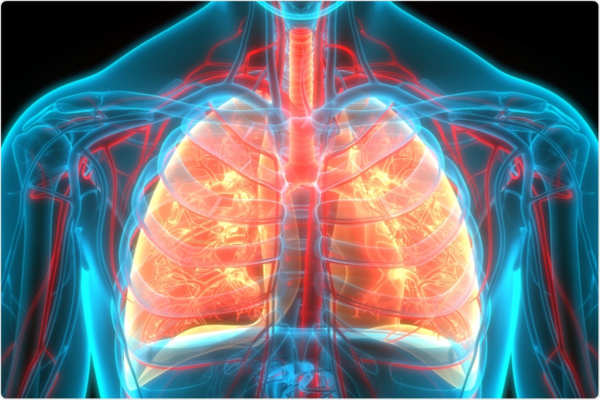 Study: Characteristics of changes in circulating markers of alveolar epithelial and endothelial injury in acute respiratory distress syndrome with COVID-19. Image Credit: / Shutterstock