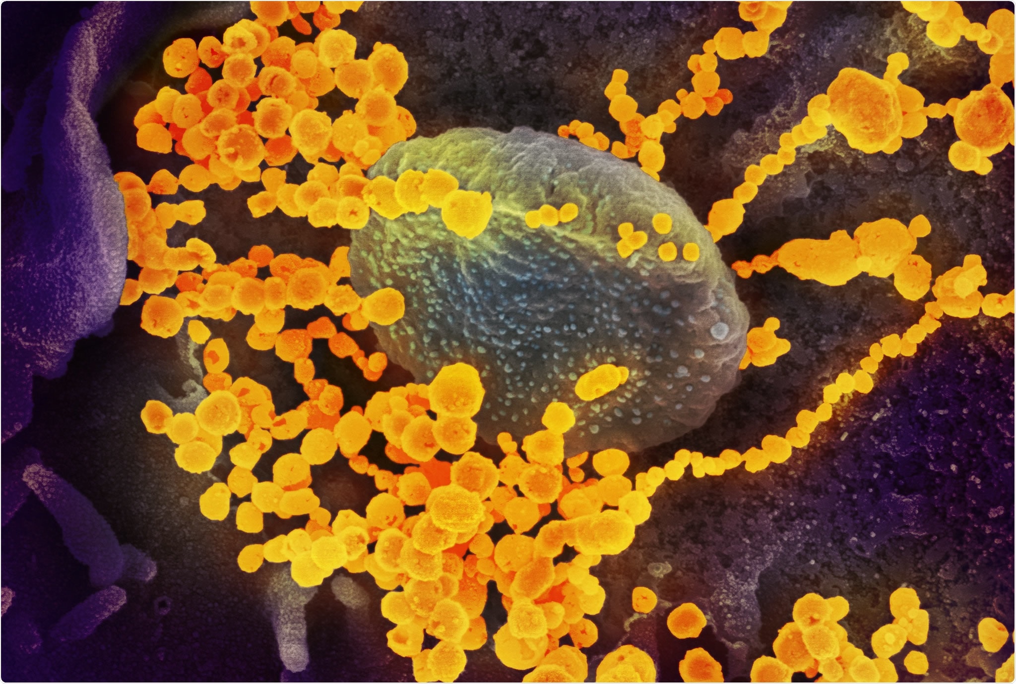 Study: Ad26.COV2.S Prevents SARS-CoV-2 Induced Pathways of Inflammation and Thrombosis in Hamsters. Image Credit: pcruciatti / Shutterstock.com