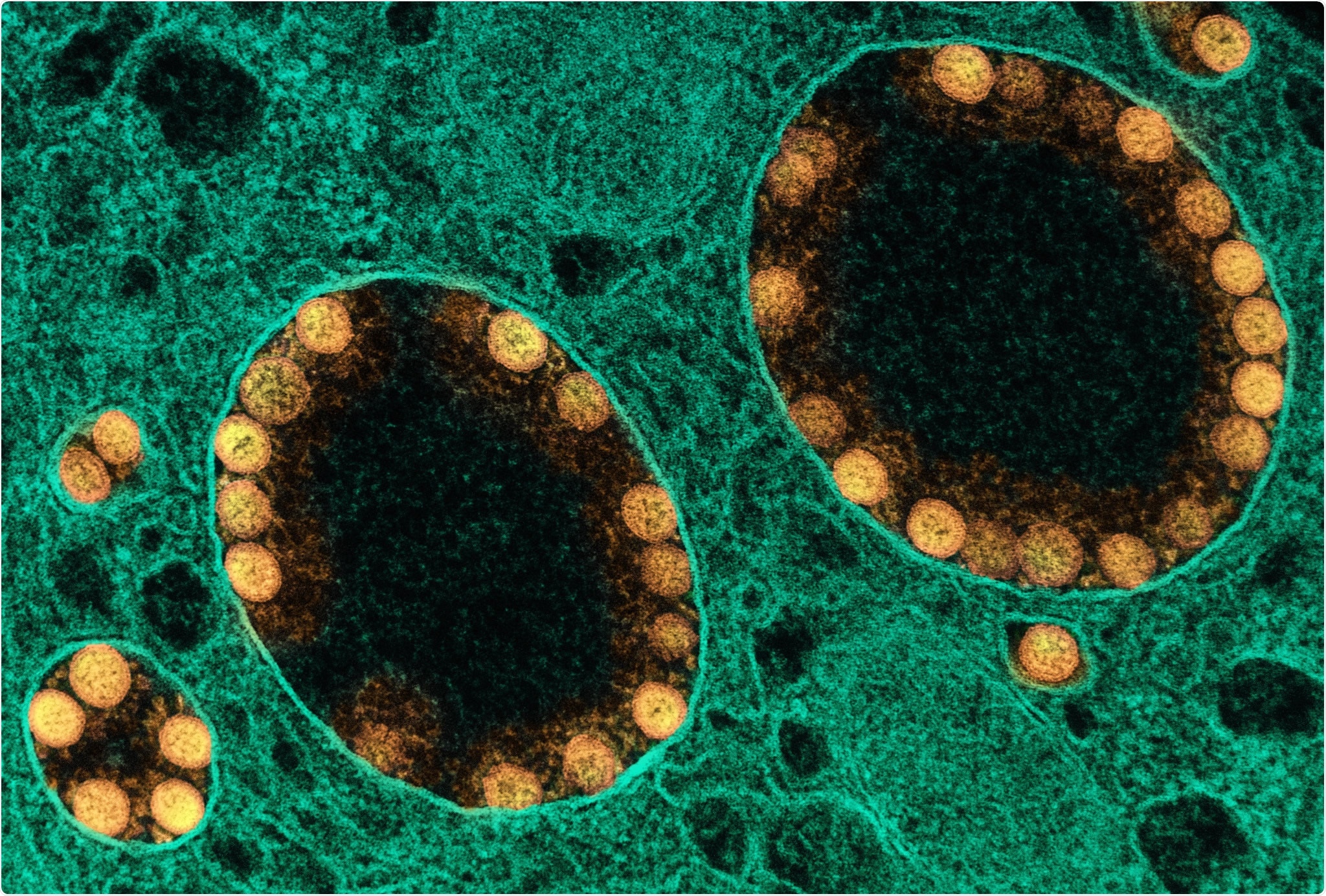 Perspective Article: Will Auranofin Become a Golden New Treatment Against COVID-19? Image Credit: NIAID