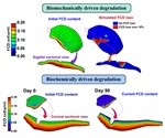 Researchers capture mechanisms for predicting cartilage degradation and recovery after ACL injury