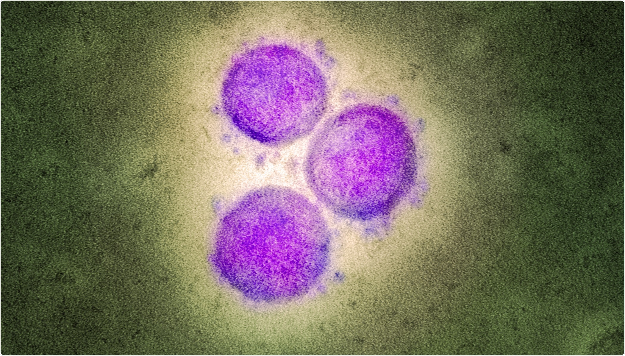 Study: Susceptibility of livestock to SARS-CoV-2 infection. Image Credit: NIAID