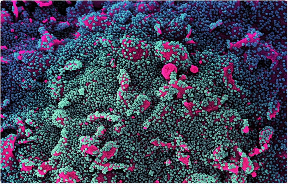 Study: Complete map of SARS-CoV-2 RBD mutations that escape the monoclonal antibody LY-CoV555 and its cocktail with LY-CoV016. Image Credit: NIAID