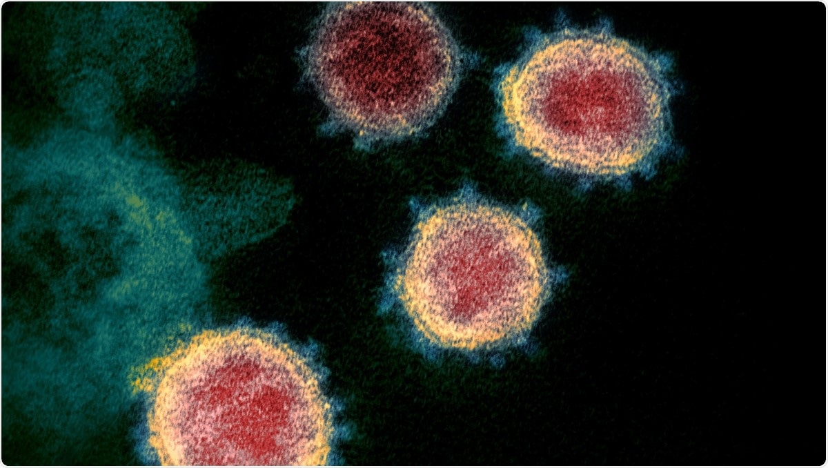 Study: Immune characterization and profiles of SARS-CoV-2 infected patients. Image Credit: NIAID / Flickr