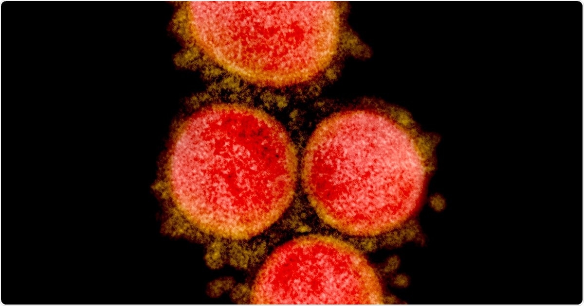 Study: COVID-19 in New York state: Effects of demographics and air quality on infection and fatality. Image Credit: NIAID / Flickr