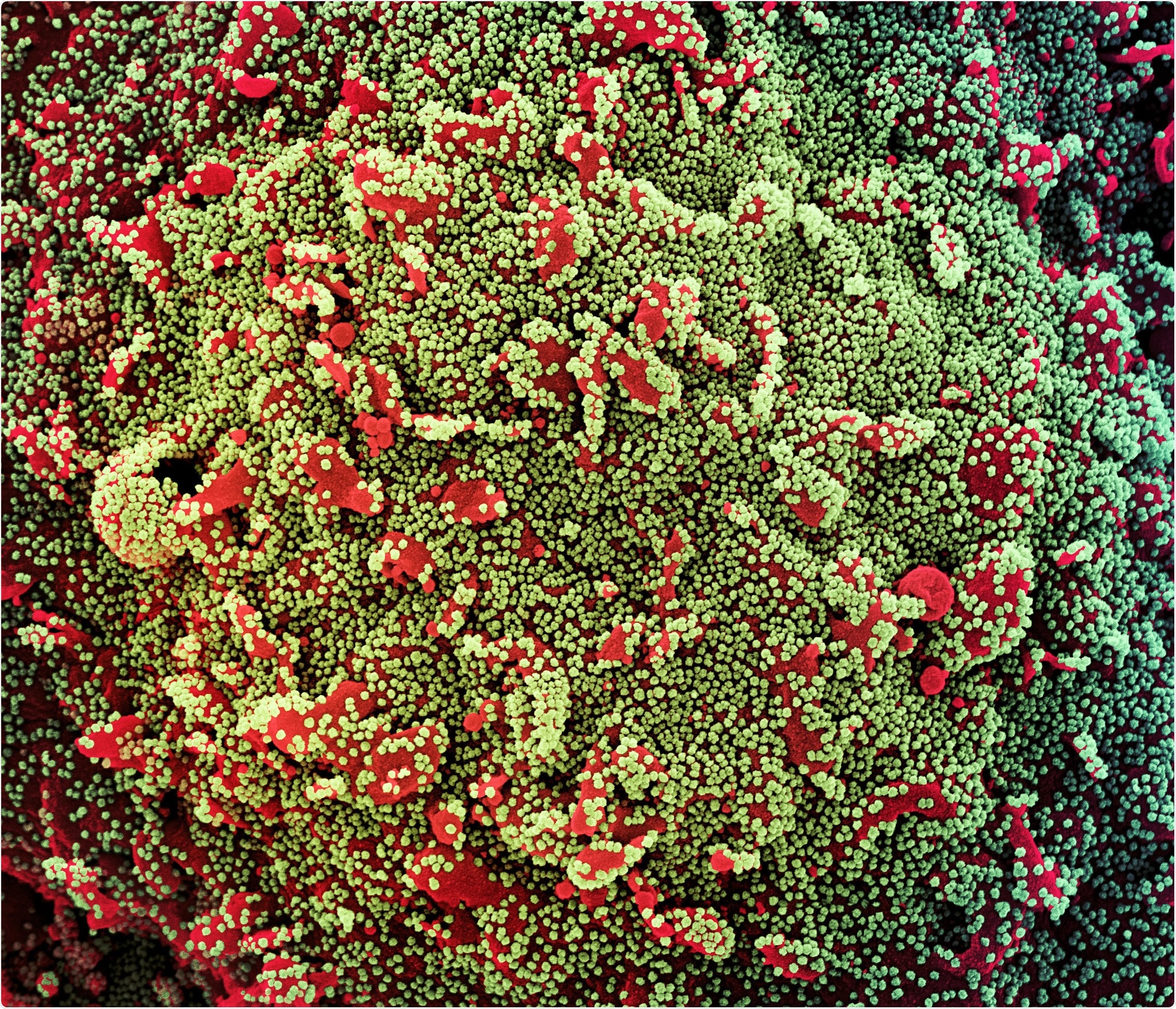 Study: Increased transmission of SARS-CoV-2 lineage B.1.1.7 (VOC 2020212/01) is not accounted for by a replicative advantage in primary airway cells or antibody escape. Image Credit: NIAID