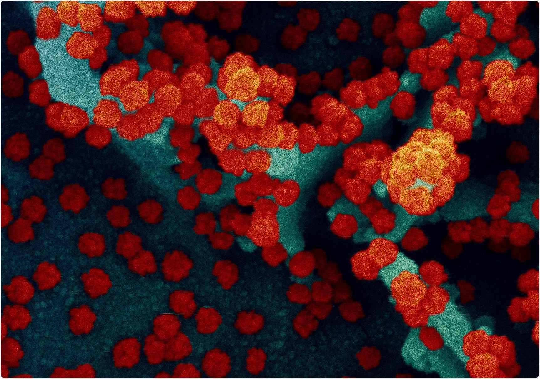 Study: Safety, tolerability, and immunogenicity of an inactivated SARS-CoV-2 vaccine (CoronaVac) in healthy adults aged 60 years and older: a randomised, double-blind, placebo-controlled, phase 1/2 clinical trial. Image Credit: NIAID