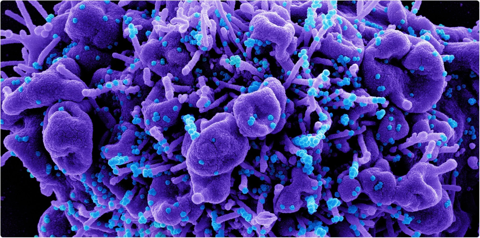 Study: Estimating the spreading and dominance of SARS-CoV-2 VOC 202012/01 (lineage B.1.1.7) across Europe. Image Credit: NIAID
