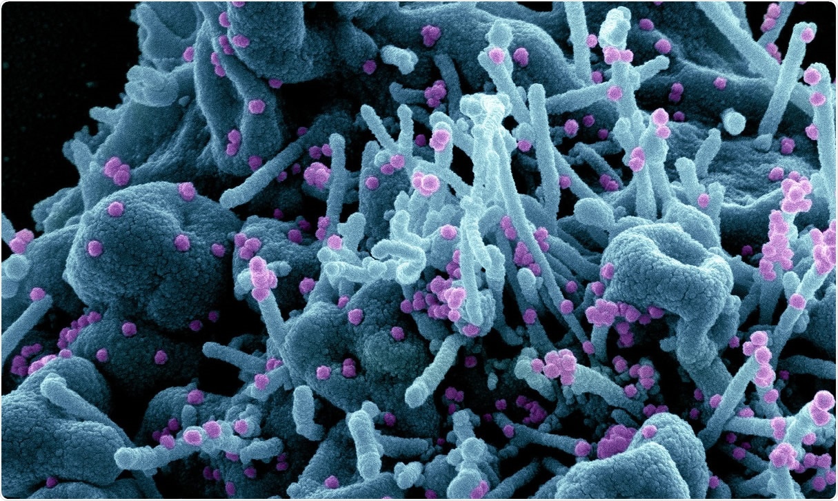 Study: High-dimensional profiling reveals phenotypic heterogeneity and disease-specific alterations of granulocytes in COVID-19. Image Credit: NIAID