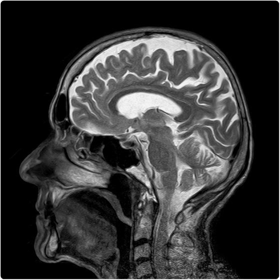 Study reveals a potential target for stroke treatment in blood-brain barrier