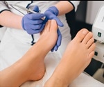 Onychomycosis Treatments
