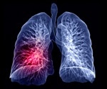 COVID-19 and lung cancer have a common pathway, say researchers