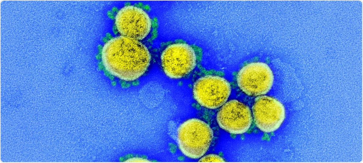 Study: CD47 as a potential biomarker for the early diagnosis of severe COVID-19. Image Credit: NIAID / Flickr