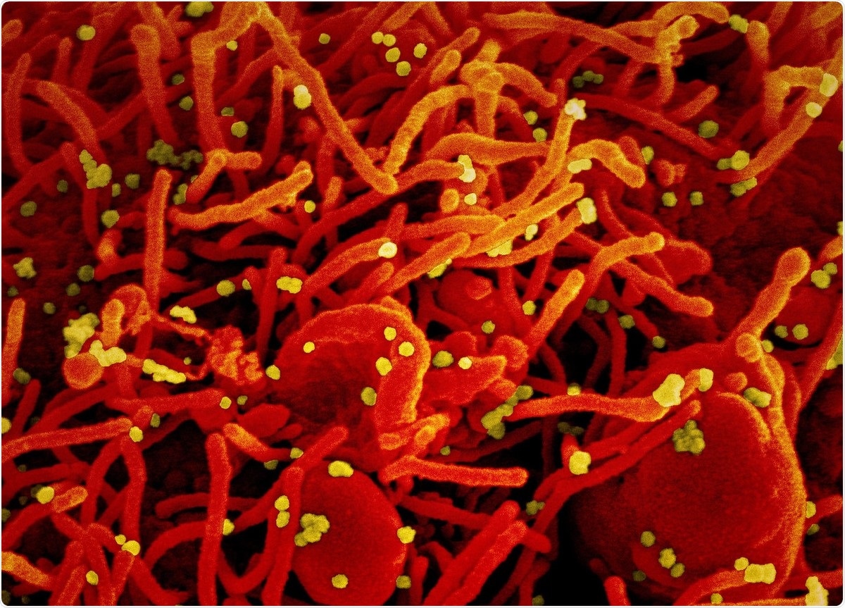 Study: A 1 to 1000 SARS-CoV-2 reinfection proportion in members of a large healthcare provider in Israel: a preliminary report. Image Credit: NIAID / Flickr