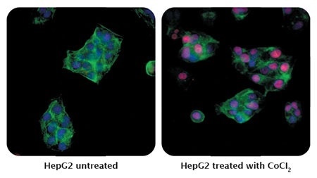 Detection of human HIF2-alpha (red) in formaldehyde-fixed asynchronous HepG2 cells untreated (left) and treated with CoCl2 (right) by ICC-IF. Antibody: Rabbit anti-HIF2-alpha recombinant monoclonal [BL-95-1A2] (A700-003). Secondary: DyLight® 594-conjugated goat anti-rabbit IgG (A120-201D4). Counterstain: DAPI (blue).