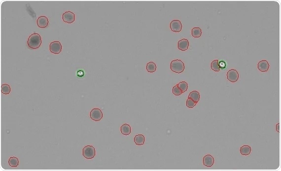Isolated nuclei counted with trypan blue on the CellDrop. The CellDrop does an excellent job of recognizing isolated nuclei in a carefully purified isolation of HEK293T cells. The nuclei are stained dark, indicating uptake of the trypan blue dye (circled red), while intact cells exclude the dye and remain bright (circled green).