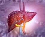 Liver Disease Symptoms