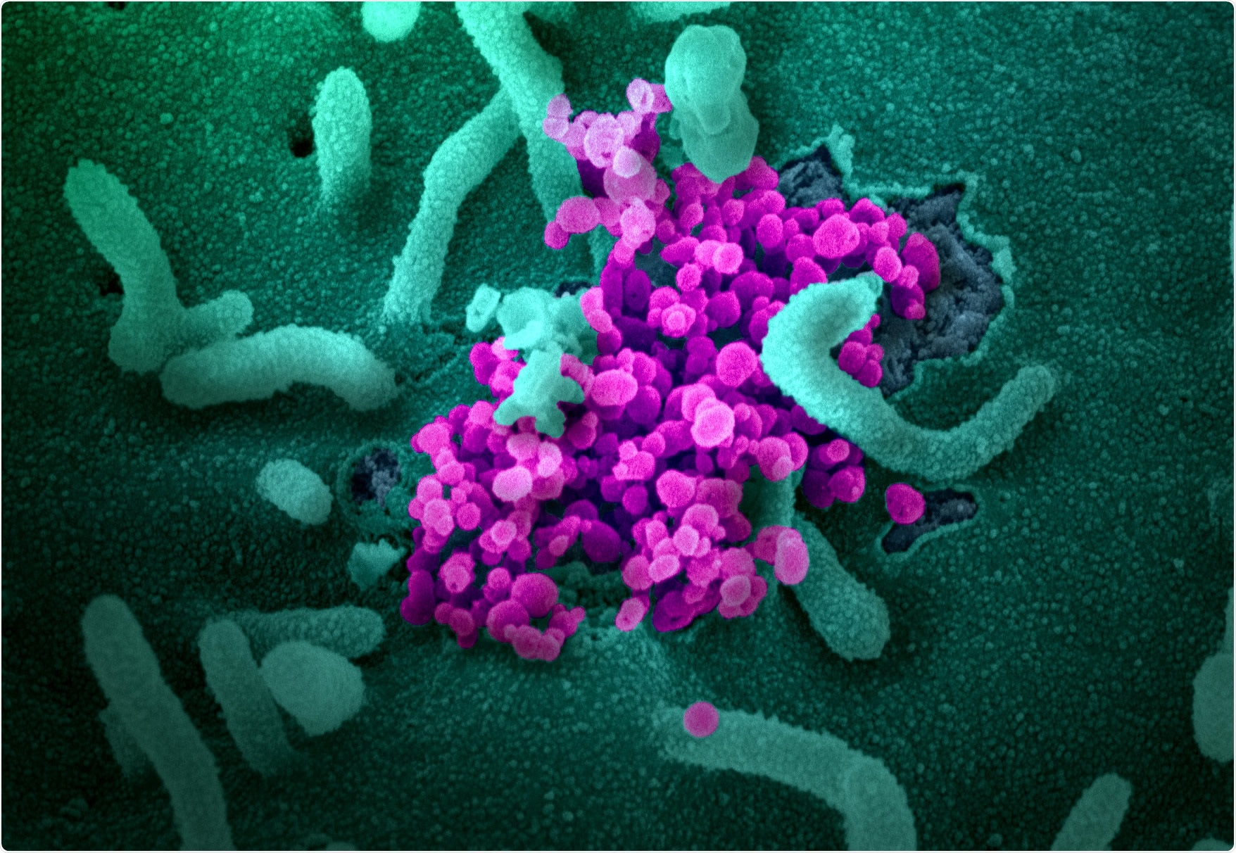 Study: Protection of previous SARS-CoV-2 infection is similar to that of BNT162b2 vaccine protection: A three-month nationwide experience from Israel. Image Credit: NIAID