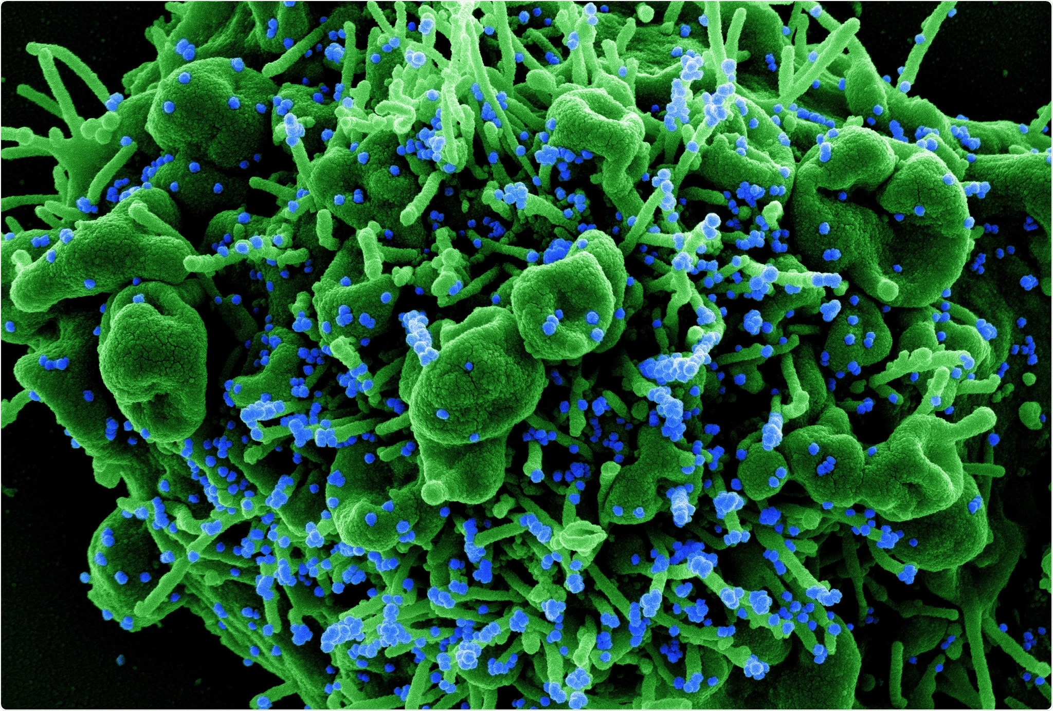 Study: Machine Learning Identifies Ponatinib as a Potent Inhibitor of SARS-CoV2-induced Cytokine Storm. Image Credit: NIAID