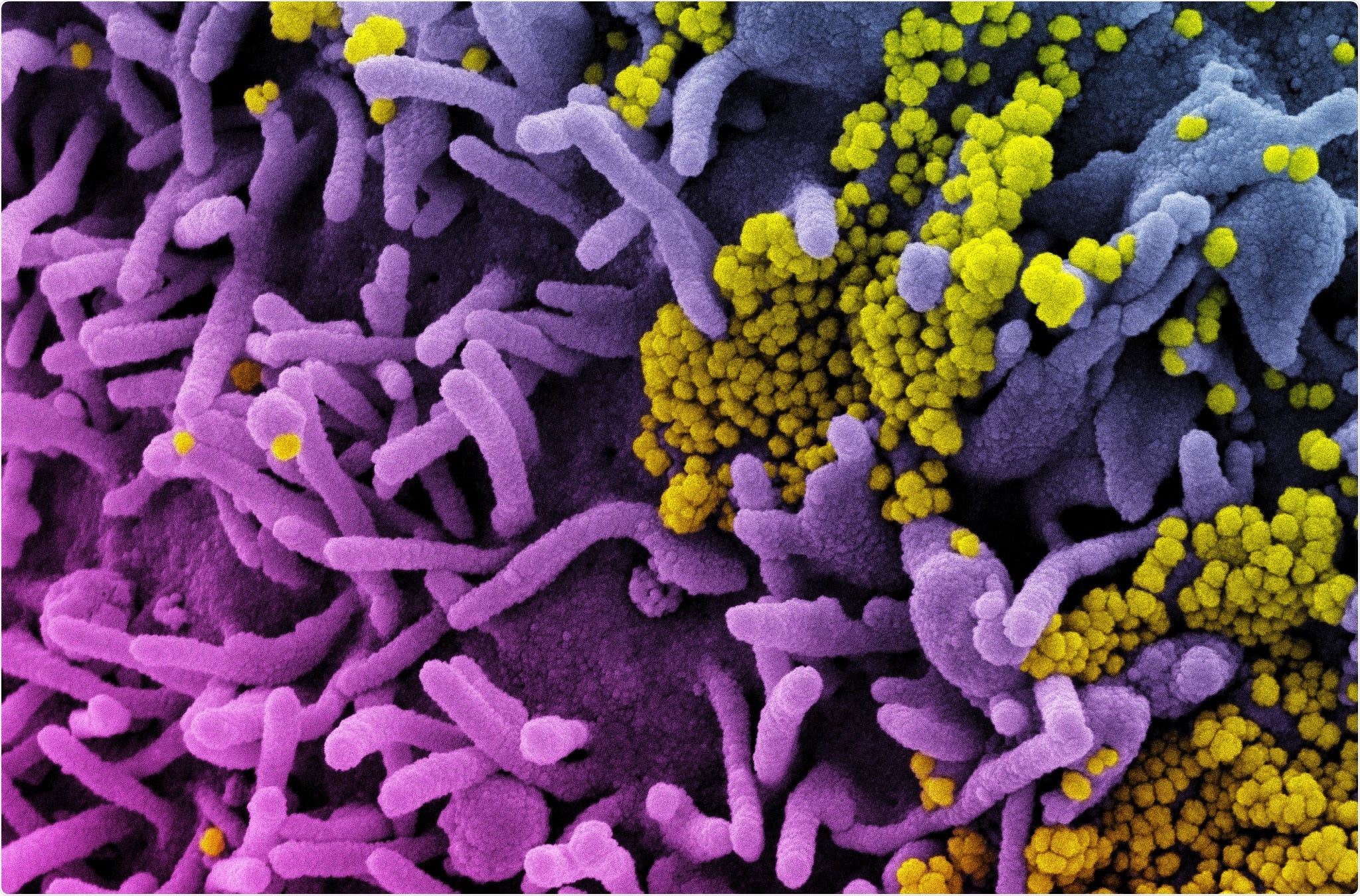 Study: Unique protein features of SARS-CoV-2 relative to other Sarbecoviruses. Image Credit: NIAID