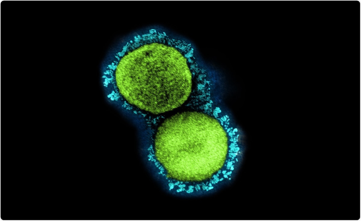 Study: Comparison of Mucosal and Intramuscular Immunization against SARS-CoV-2 with Replication-Defective and Replicating Single-cycle Adenovirus Vaccines. Image Credit: NIAID