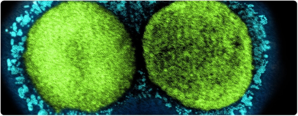Study: Distinct antibody and memory B cell responses in SARS-CoV-2 naïve and recovered individuals following mRNA vaccination