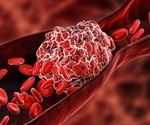 Thrombosis Prevention
