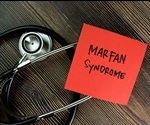 Marfan Syndrome Diagnosis