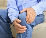 Osteoarthritis Symptoms