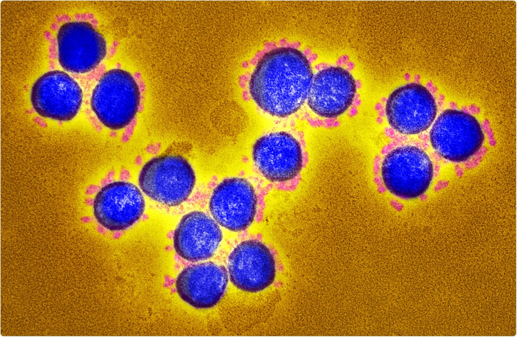 Study: Diverse Functional Autoantibodies in Patients with COVID-19. Image Credit: NIAID