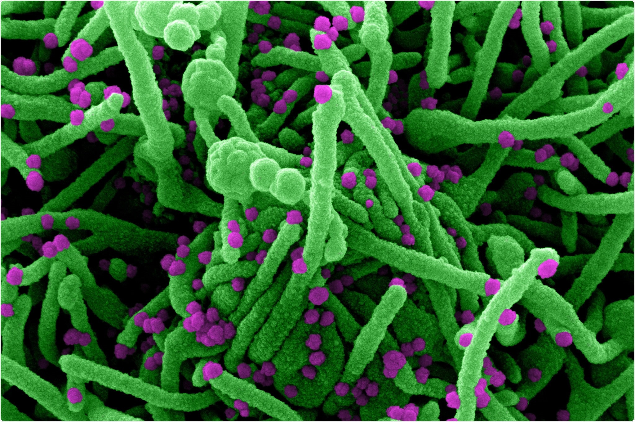 Study: Previously infected vaccinees broadly neutralize SARS-CoV-2 variants. Image Credit: NIAID