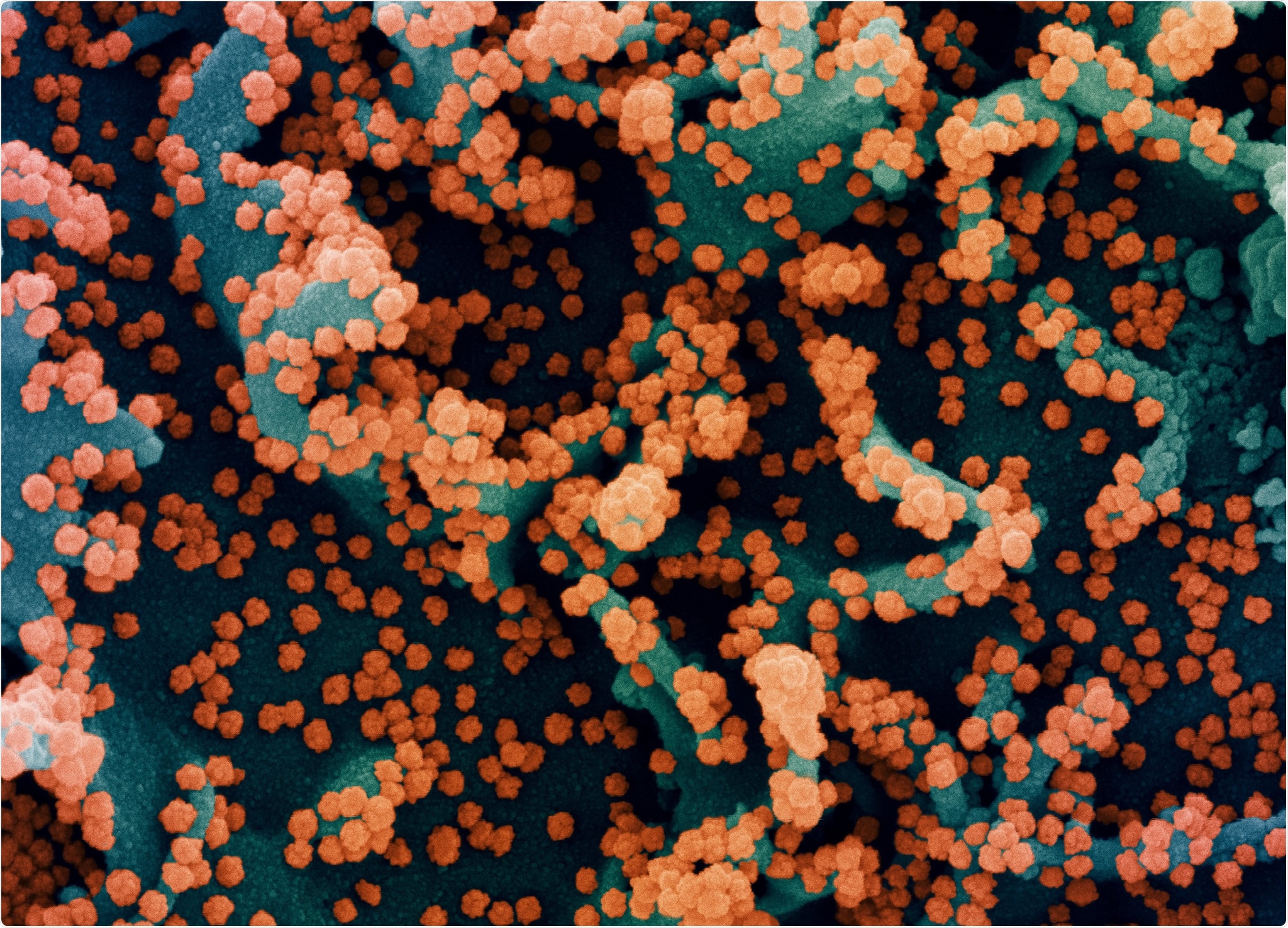 Study: Neutralizing antibody levels are highly predictive of immune protection from symptomatic SARS-CoV-2 infection. Image Credit: NIAID