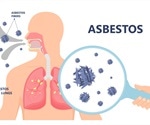 Mesothelioma Pathophysiology