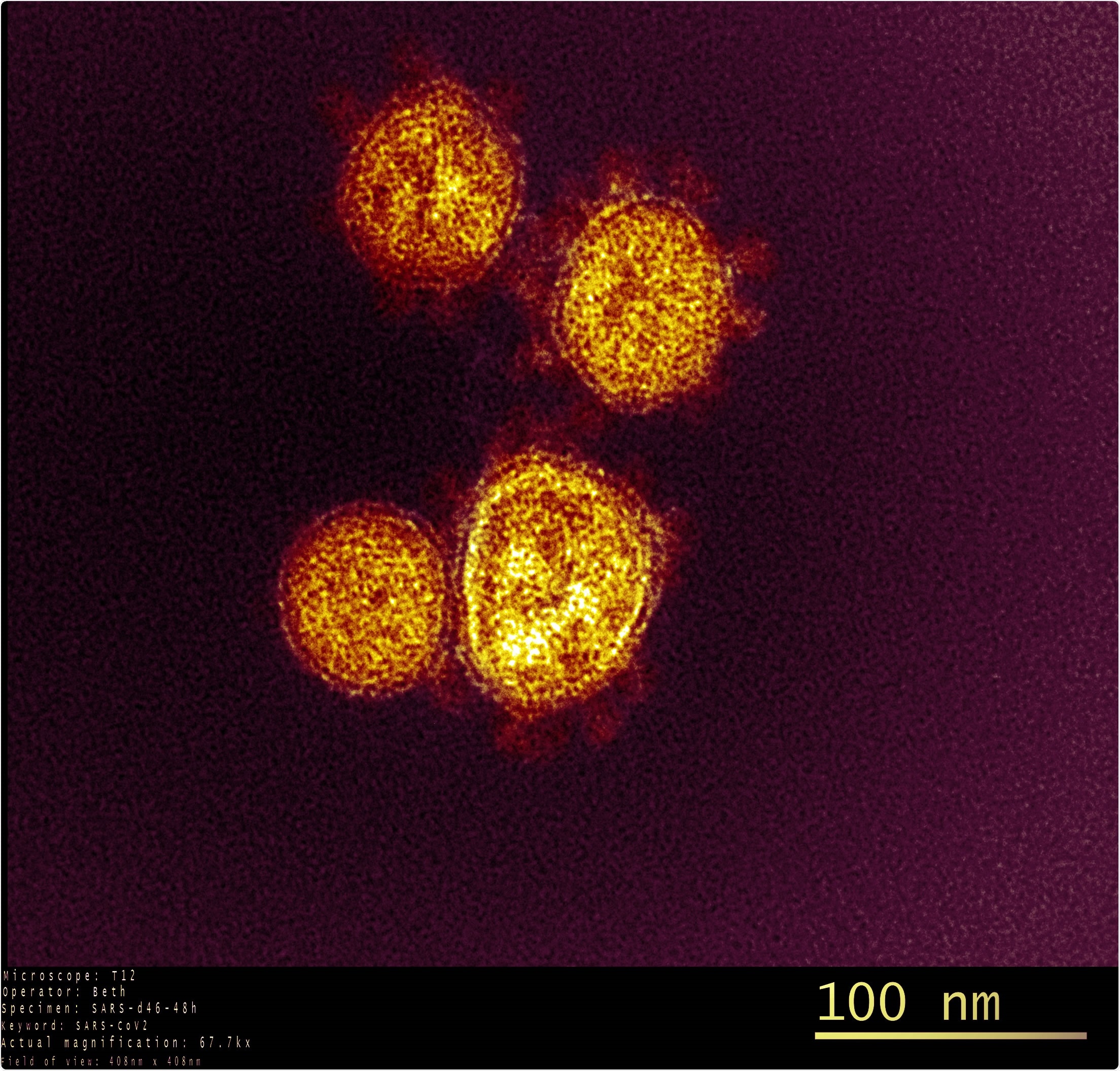 Study: Drug repurposing based on a Quantum-Inspired method versus classical fingerprinting uncovers potential antivirals against SARS-CoV-2 including vitamin B12. Image Credit: NIAID