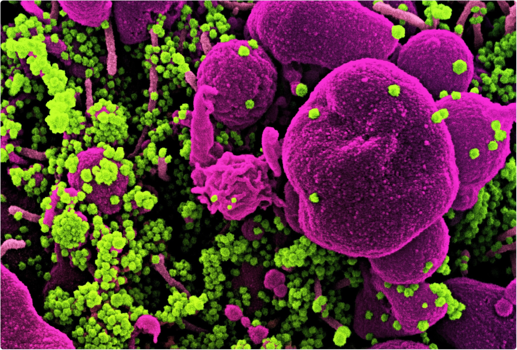 Study: Immunogenicity and In vivo protection of a variant nanoparticle vaccine that confers broad protection against emerging SARS-CoV-2 variants. Image Credit: NIAID