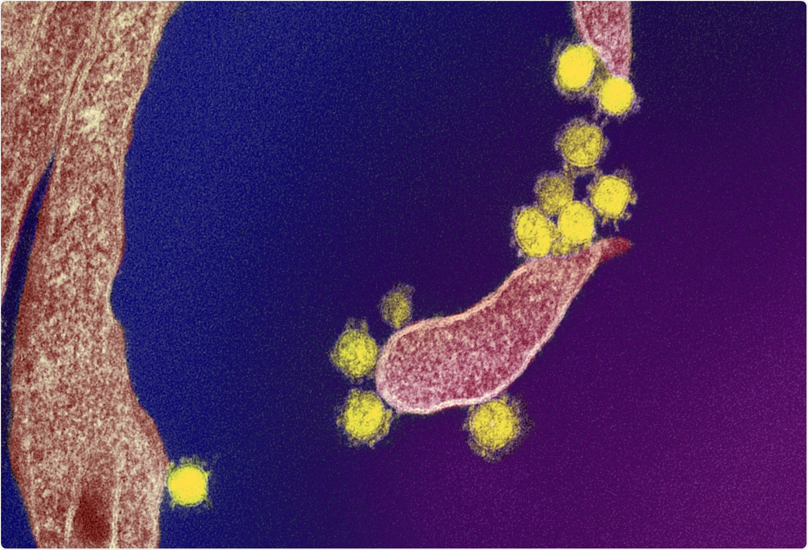 Study: Inflection in prevalence of SARS-CoV-2 infections missing the N501Y mutation as a marker of rapid Delta (B.1.617.2) lineage expansion in Ontario, Canada. Image Credit: NIAID