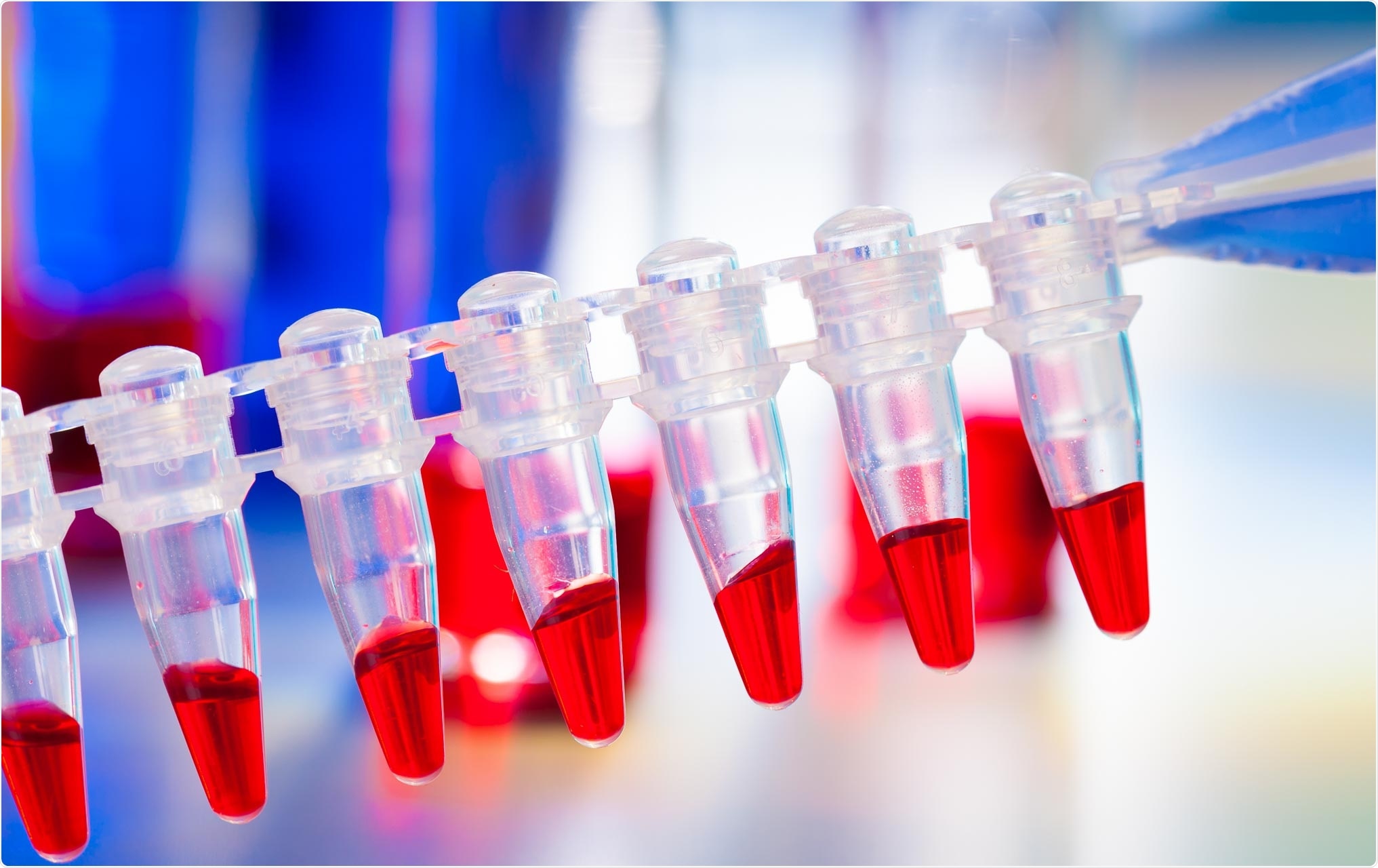 Review: Carbon-Based Nanomaterials: Promising Antiviral Agents to Combat COVID-19 in the Microbial-Resistant Era. Image Credit: LuchschenF / Shutterstock