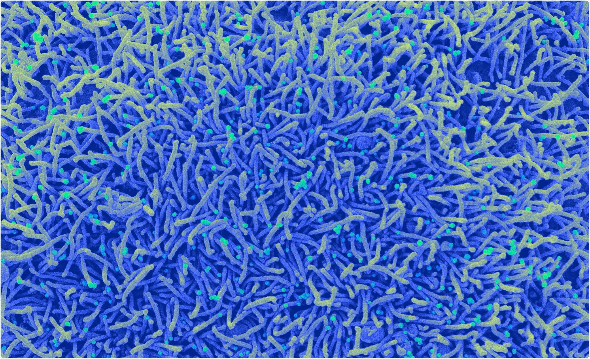 Study: A photoactivable natural product with broad antiviral activity against enveloped viruses including highly pathogenic coronaviruses. Image Credit: NIAID