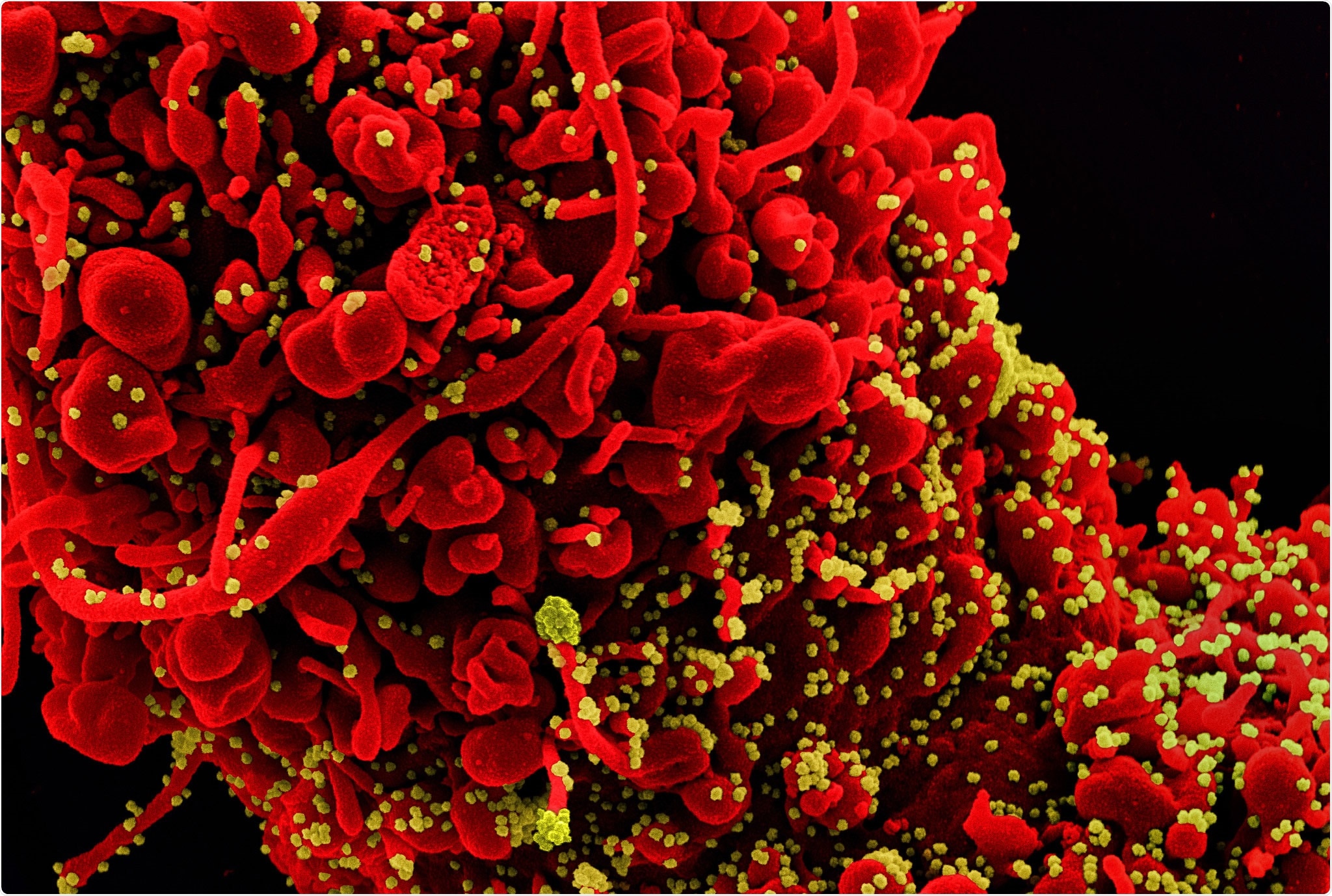 Study: Neutralization of Delta variant with sera of Covishield vaccinees and COVID-19 recovered vaccinated individuals. Image Credit: NIAID