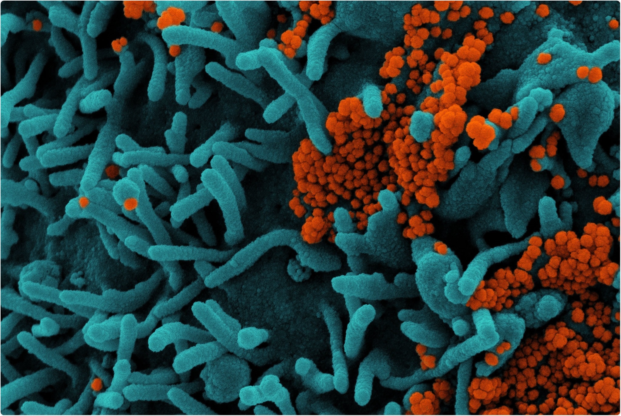 Study: Impaired SARS-CoV-2 mRNA vaccine antibody response in chronic medical conditions: a real-world data analysis. Image Credit: NIAID