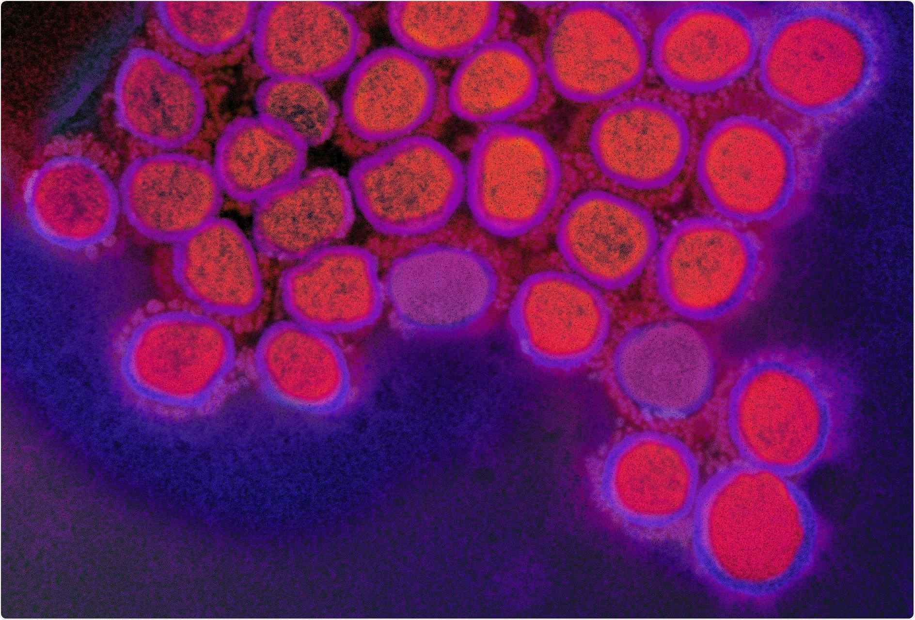 Study: But Mouse, you are not alone: On some severe acute respiratory syndrome coronavirus 2 variants infecting mice. Image Credit: NIAID