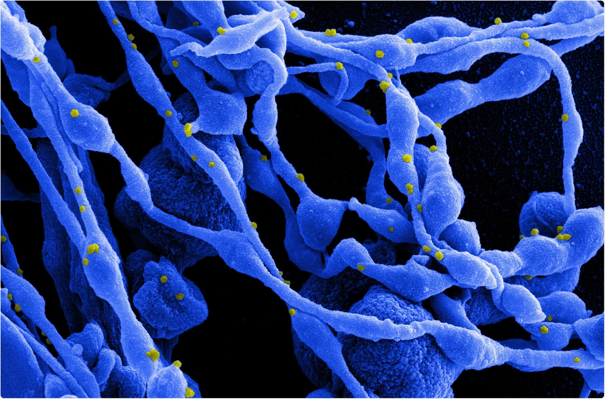 Study: Rapid spread of a SARS-CoV-2 Delta variant with a frameshift deletion in ORF7a. Image Credit: NIAID