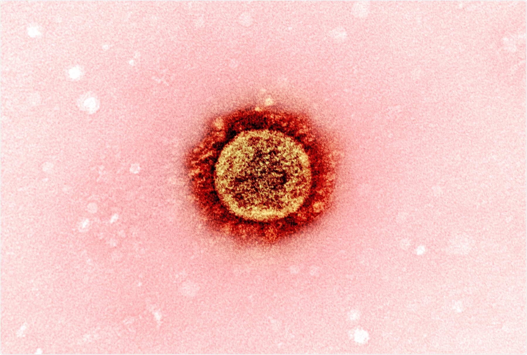 Study: Risk of severe COVID-19 outcomes associated with immune-mediated inflammatory diseases and immune modifying therapies: a nationwide cohort study in the OpenSAFELY platform. Image Credit: NIAID
