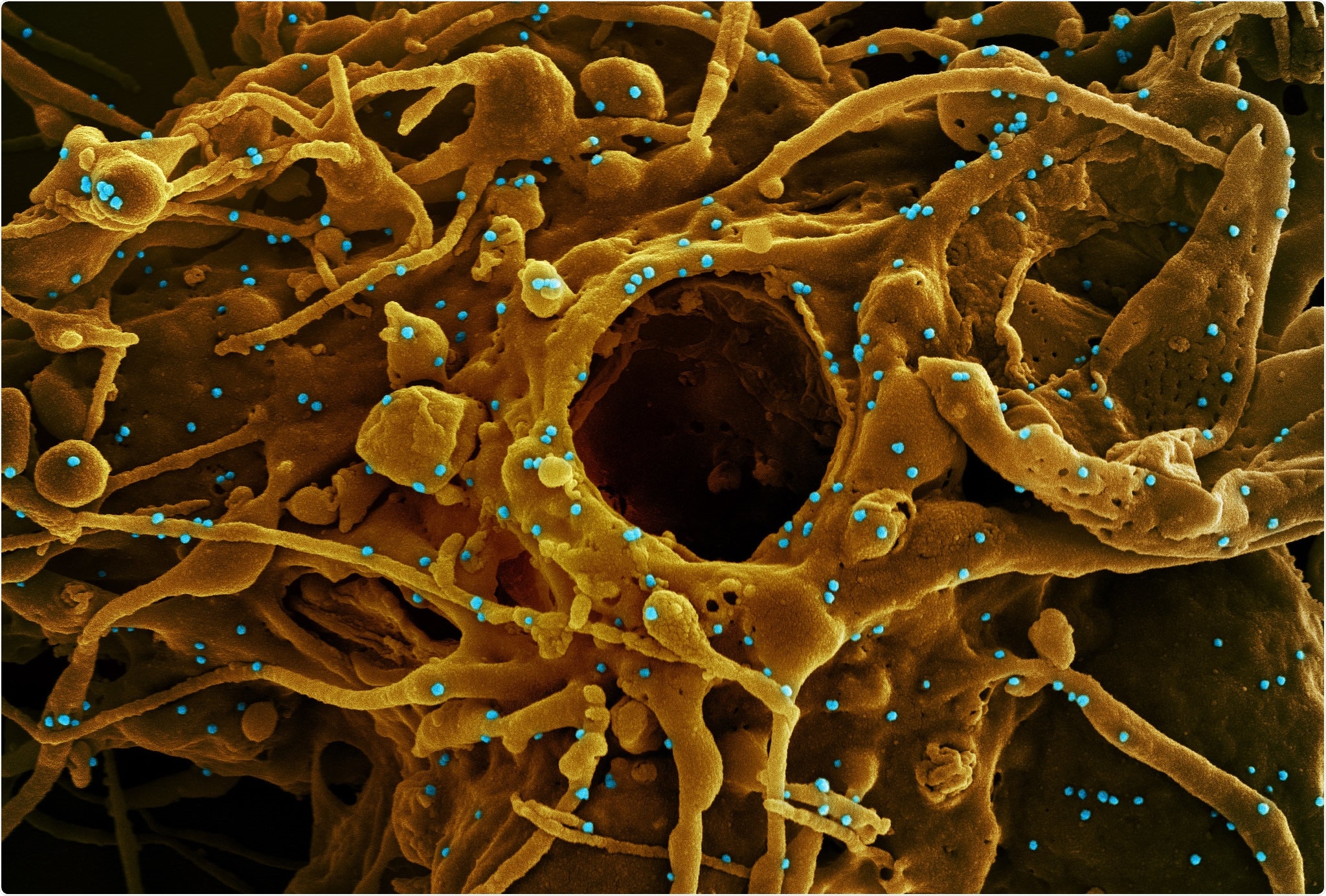 Study: Targeting Stem-loop 1 of the SARS-CoV-2 5’UTR to suppress viral translation and Nsp1 evasion. Image Credit: NIAID