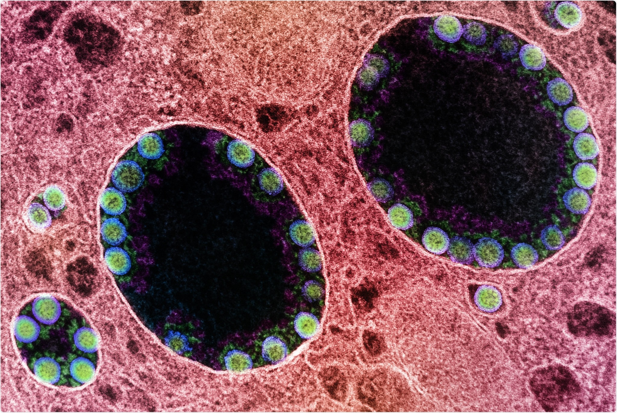 Study: Effectiveness of COVID-19 vaccines against SARS-CoV-2 variants of concern: a systematic review and meta-analysis. Image Credit: NIAID