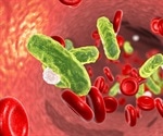 Study supports the implementation of Beckman Coulter’s MDW in emergency labs as initial test to detect sepsis